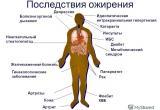 За пять лет число страдающих ожирением россиян выросло почти в полтора раза
