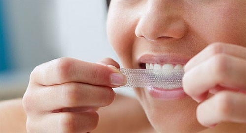 Что нужно помнить, чтобы не терять зубы?