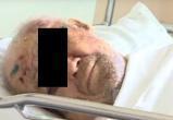 Двое череповчан избили и ограбили 79-летнего пенсионера