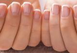 Болезнь можно распознать по цвету ногтей