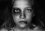 В Вологодской области выросло число случаев жестокого обращения с детьми