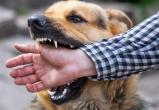В Белозерске владельцы собак ответили рублем за покусанных детей