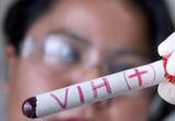 Невиданными ранее темпами в этом году ВИЧ идет по Вологодчине