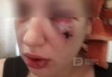 В Вологде пойдет под суд пенсионерка, избившая соседку и её мать: Сломанная челюсть и перелом сустава итог схватки 