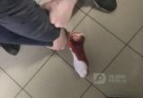 Стрельба в Череповце: в подростка стрелял неизвестный мужчина - парень в больнице (ФОТО) 
