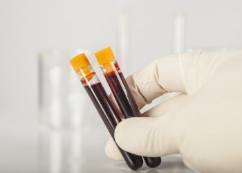Медики рассказали о зависимости продолжительности жизни от группы крови