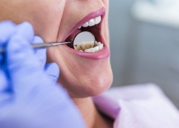 Зачем проверять состояние зубной пломбы