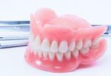 Какое протезирование зубов подходит вам и где его сделать в Вологде-2
