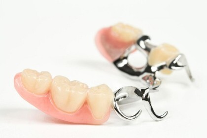 Бюгельный протез