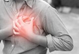 Инфаркт миокарда: кто в зоне риска