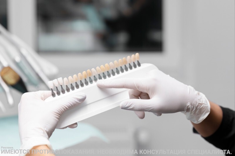 Честная стоматология: вся правда и мифы о винирах