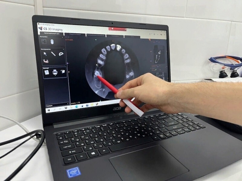 Стратегия здоровой улыбки от "Дента Стиль": почему так важен план лечения 