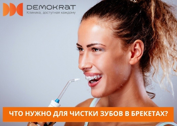 Какие аксессуары нужно взять в помощники для чистки зубов в брекетах?