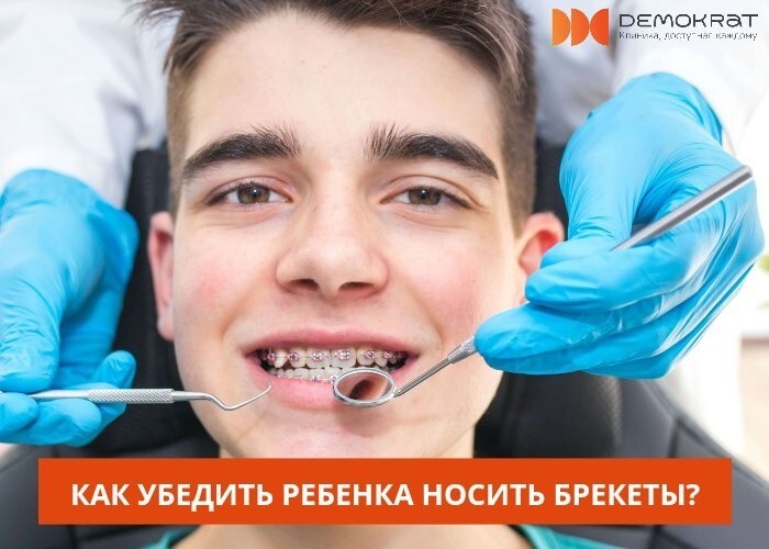 Как убедить ребенка носить брекеты?