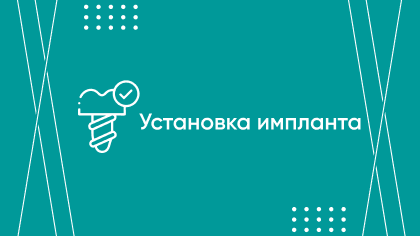 Установка импланта