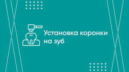 Установка коронки на зуб