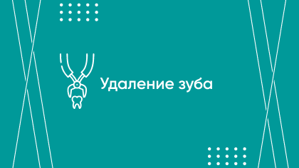 Удаление зуба