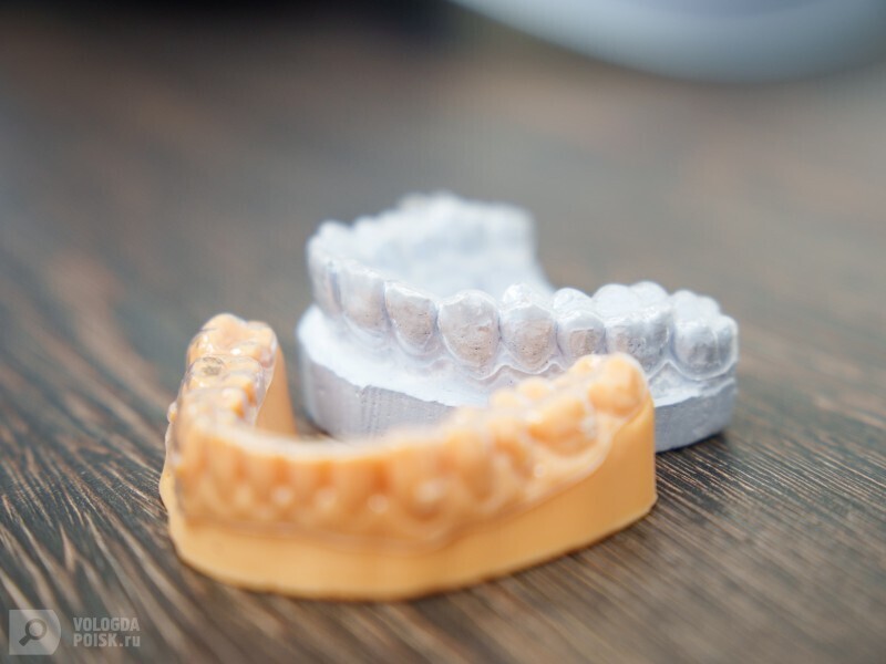 Почему нельзя откладывать протезирование зубов: важные факты от специалистов