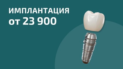 Имплантация с установкой от 23 900₽