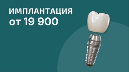 Имплантация с установкой от 19 900₽