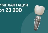 Имплантация с установкой от 23 900₽
