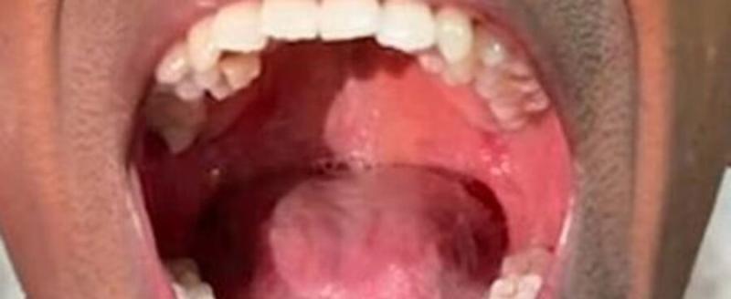 Facebook (владелец компания Meta признана в России экстремистской и запрещена)