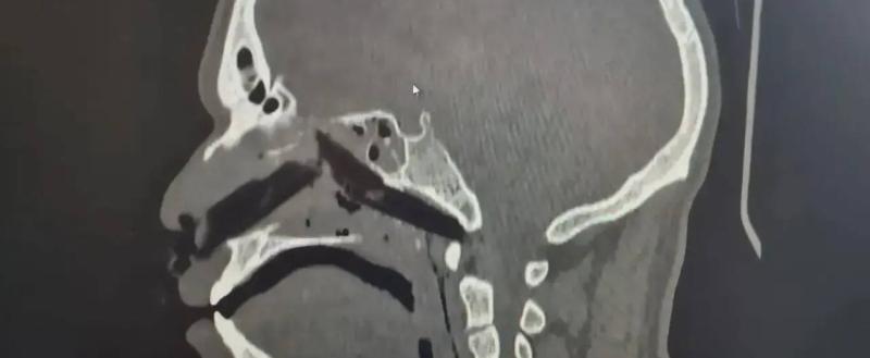 Минздрав Вологодской области