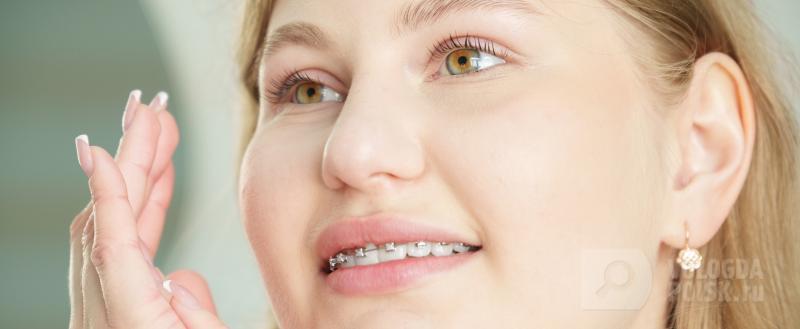Брекеты &ndash; выгодная инвестиция в себя