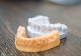 Съемное протезирование вернет вам способность есть с аппетитом и улыбаться с удовольствием