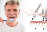 Выгодная имплантация зубов в стоматологии «Демократ»