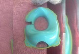 Спасатели применили кусачки, спасая 2-летнюю девочку в Вологодской области 