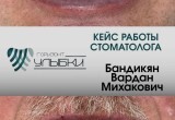 Знакомство с врачом