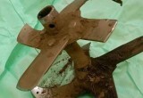 Вологодские врачи спасли жизнь пенсионера с лопастью культиватора в ноге